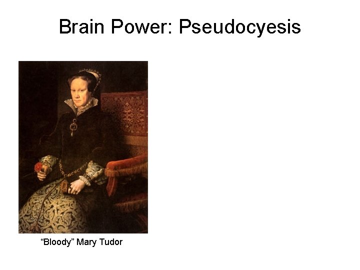 Brain Power: Pseudocyesis “Bloody” Mary Tudor Brain Power: Pseudocyesis “Bloody” Mary Tudor