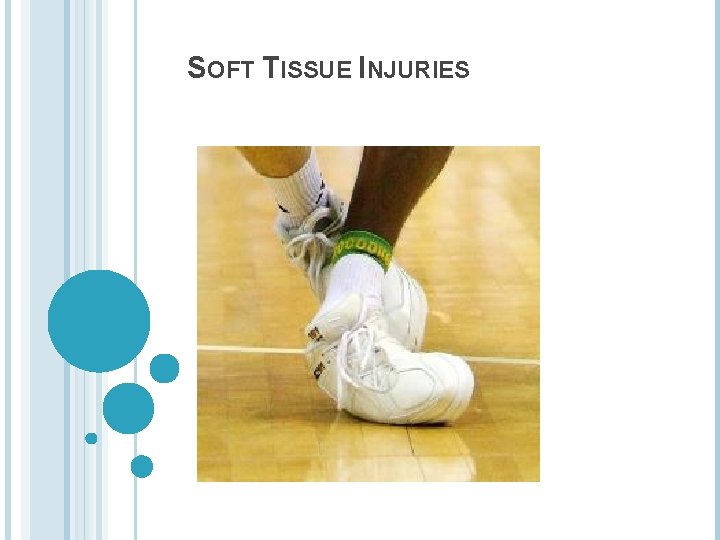 SOFT TISSUE INJURIES 