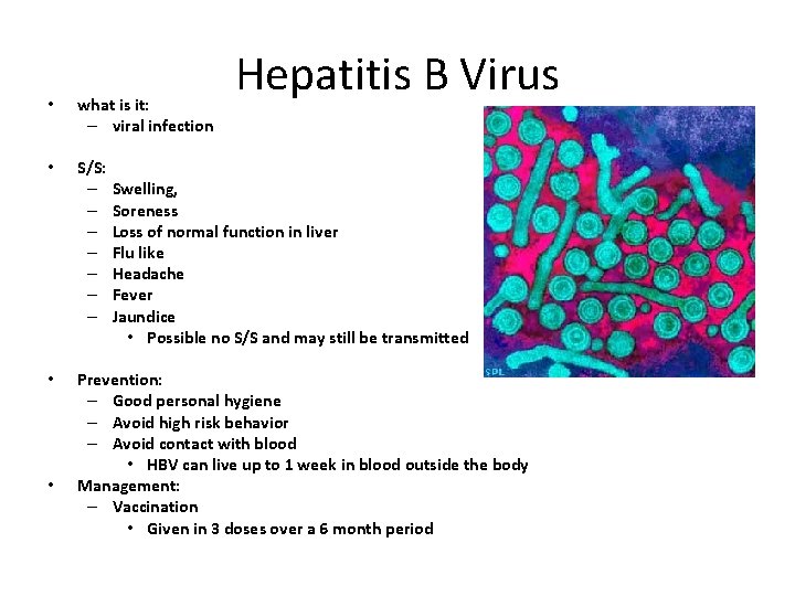  • what is it: – viral infection • S/S: – – – –