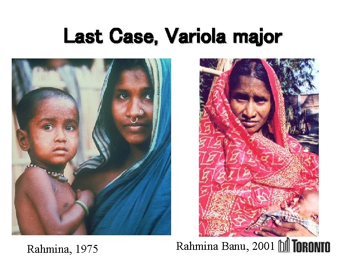 Last Case, Variola major Rahmina, 1975 Rahmina Banu, 2001 