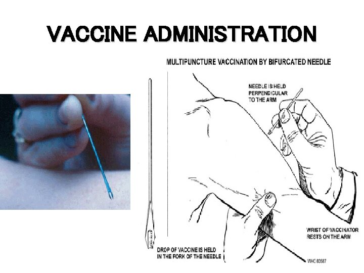 VACCINE ADMINISTRATION 