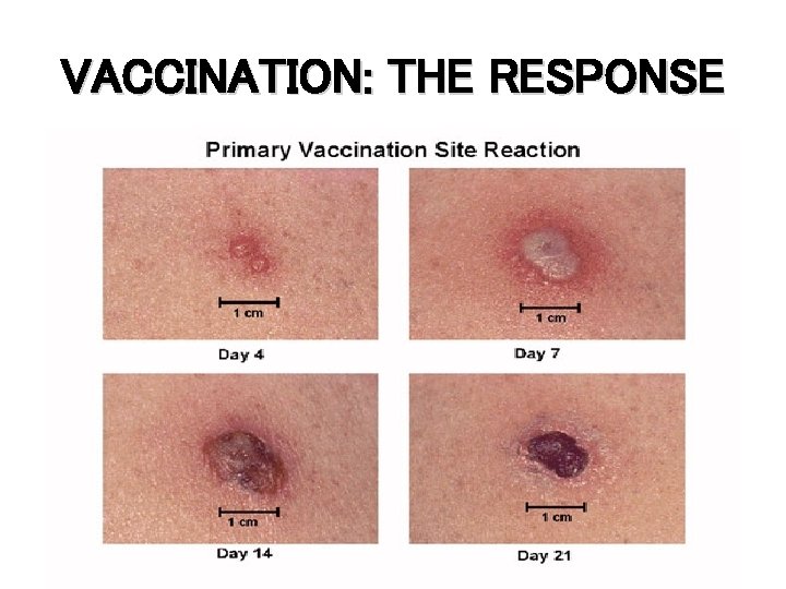 VACCINATION: THE RESPONSE 