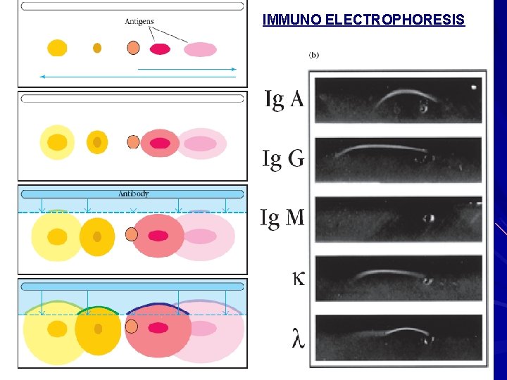 IMMUNO ELECTROPHORESIS 