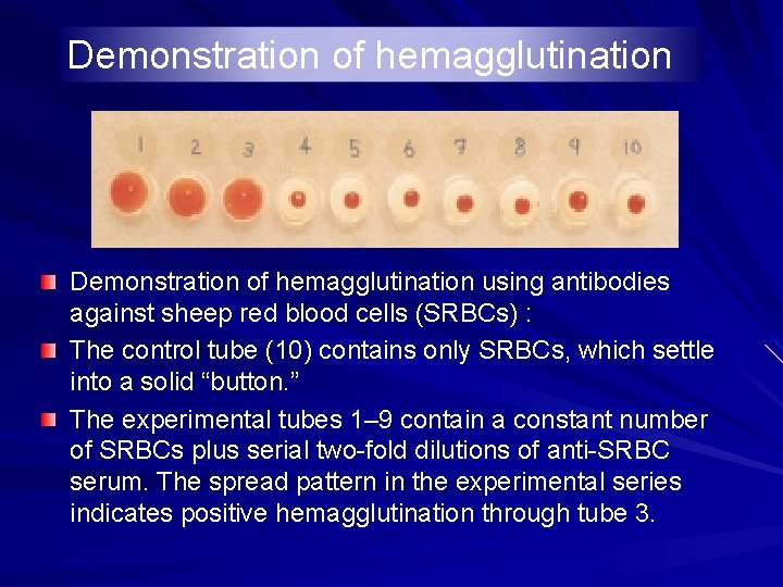 Demonstration of hemagglutination using antibodies against sheep red blood cells (SRBCs) : The control