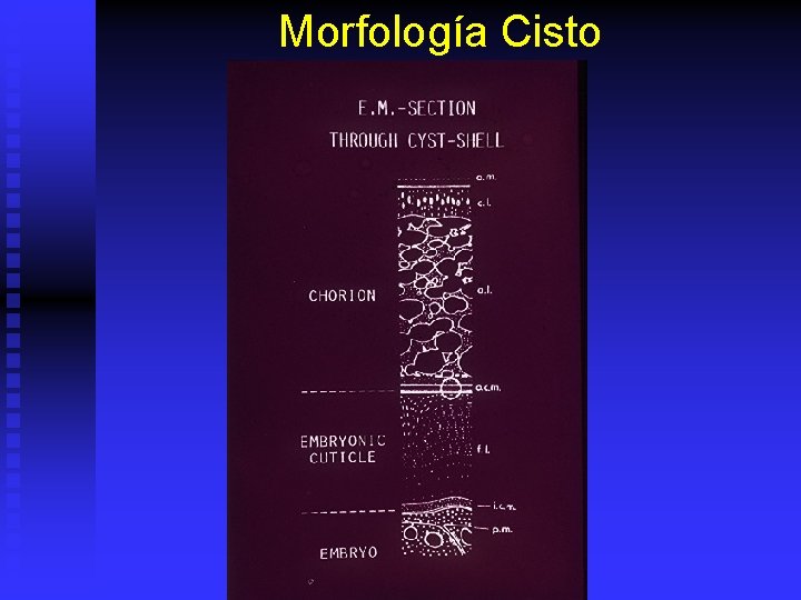 Morfología Cisto 