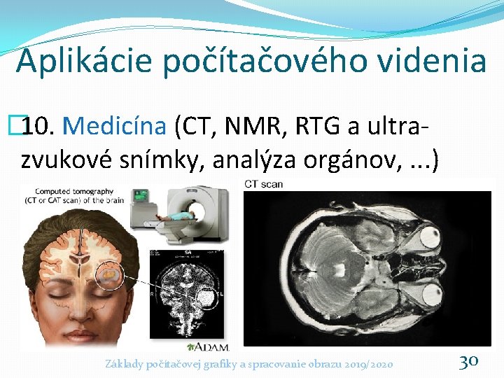 Aplikácie počítačového videnia � 10. Medicína (CT, NMR, RTG a ultrazvukové snímky, analýza orgánov,