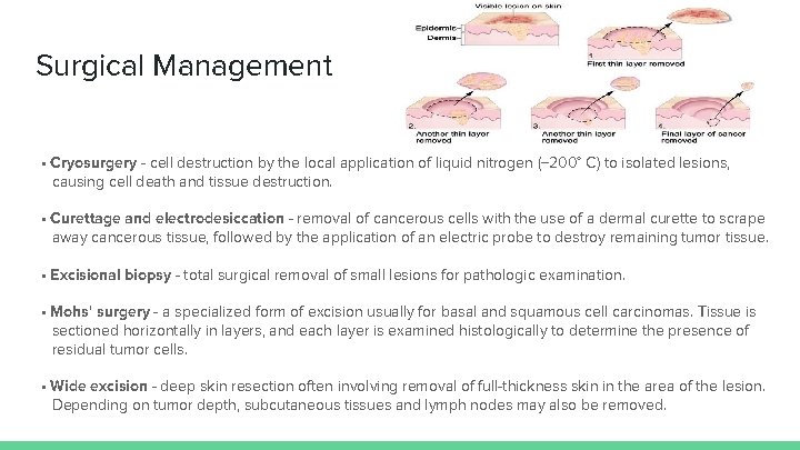 Surgical Management • Cryosurgery - cell destruction by the local application of liquid nitrogen