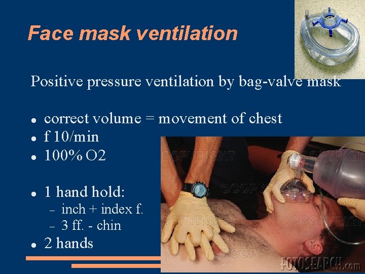 Face mask ventilation Positive pressure ventilation by bag-valve mask correct volume = movement of