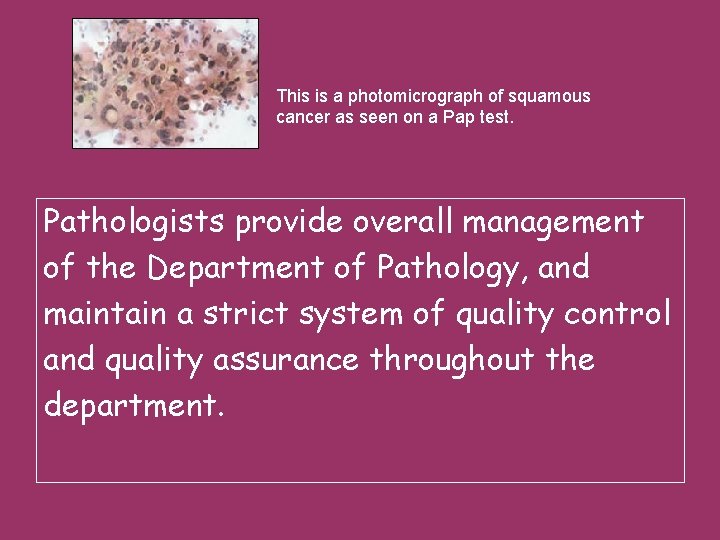 This is a photomicrograph of squamous cancer as seen on a Pap test. Pathologists