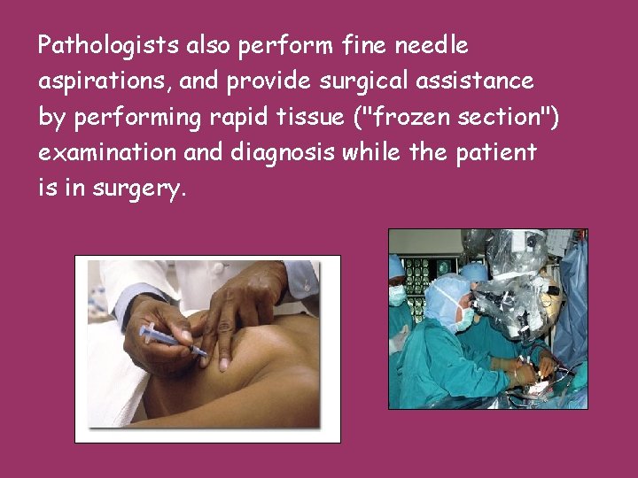 Pathologists also perform fine needle aspirations, and provide surgical assistance by performing rapid tissue