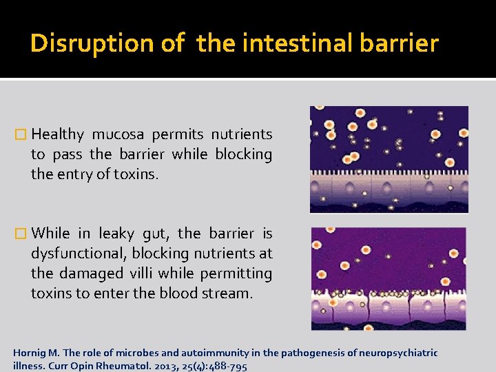 Disruption of the intestinal barrier � Healthy mucosa permits nutrients to pass the barrier