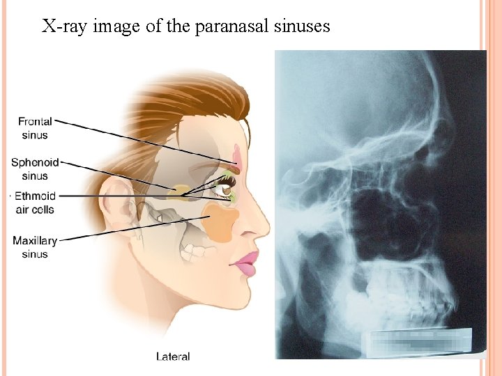 X-ray image of the paranasal sinuses 
