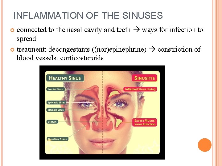 INFLAMMATION OF THE SINUSES connected to the nasal cavity and teeth ways for infection