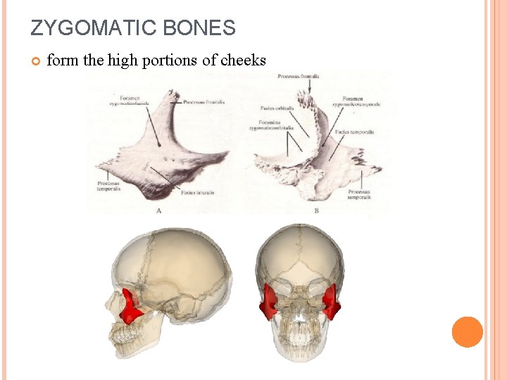 ZYGOMATIC BONES form the high portions of cheeks 