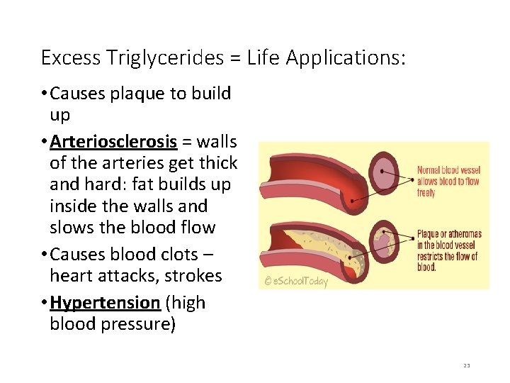 Excess Triglycerides = Life Applications: • Causes plaque to build up • Arteriosclerosis =