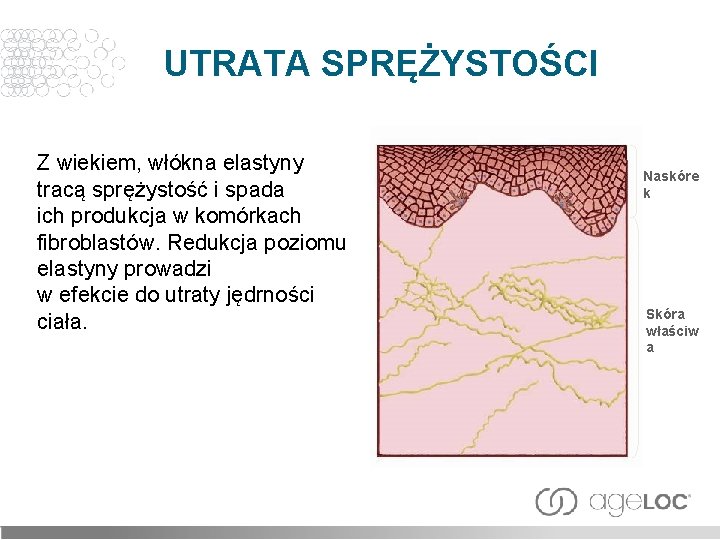 UTRATA SPRĘŻYSTOŚCI Z wiekiem, włókna elastyny tracą sprężystość i spada ich produkcja w komórkach