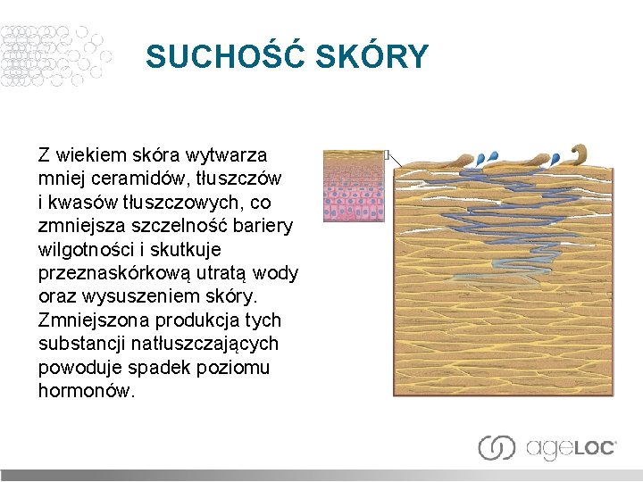 SUCHOŚĆ SKÓRY Z wiekiem skóra wytwarza mniej ceramidów, tłuszczów i kwasów tłuszczowych, co zmniejsza