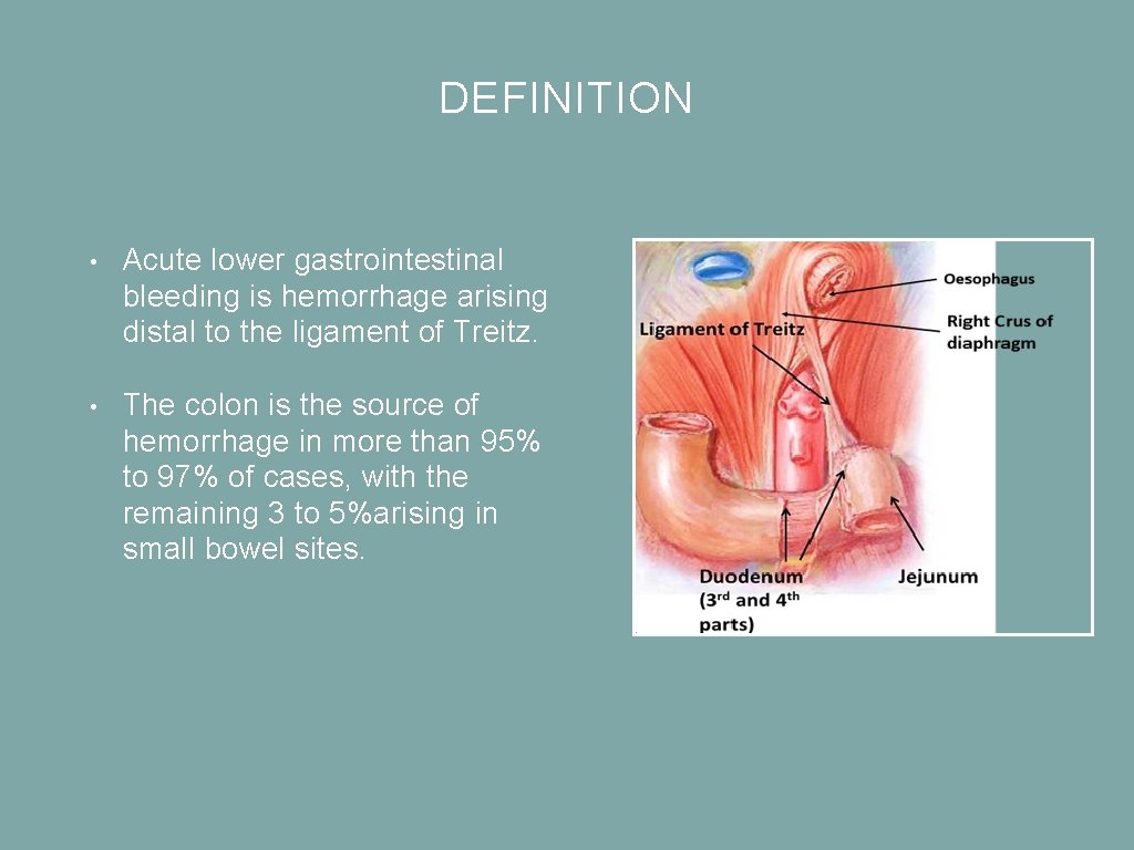 DEFINITION • Acute lower gastrointestinal bleeding is hemorrhage arising distal to the ligament of