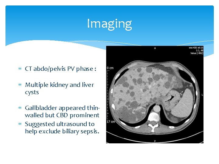 Imaging CT abdo/pelvis PV phase : Multiple kidney and liver cysts Gallbladder appeared thinwalled