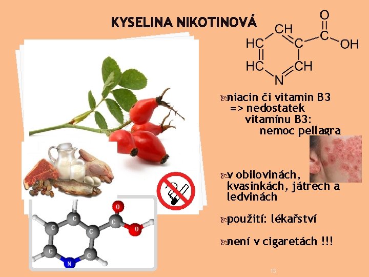 KYSELINA NIKOTINOVÁ niacin či vitamin B 3 => nedostatek vitamínu B 3: nemoc pellagra