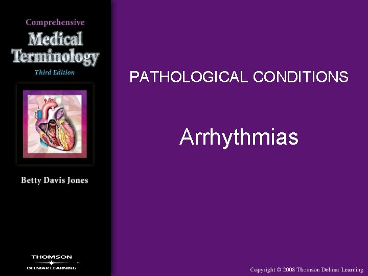 PATHOLOGICAL CONDITIONS Arrhythmias 