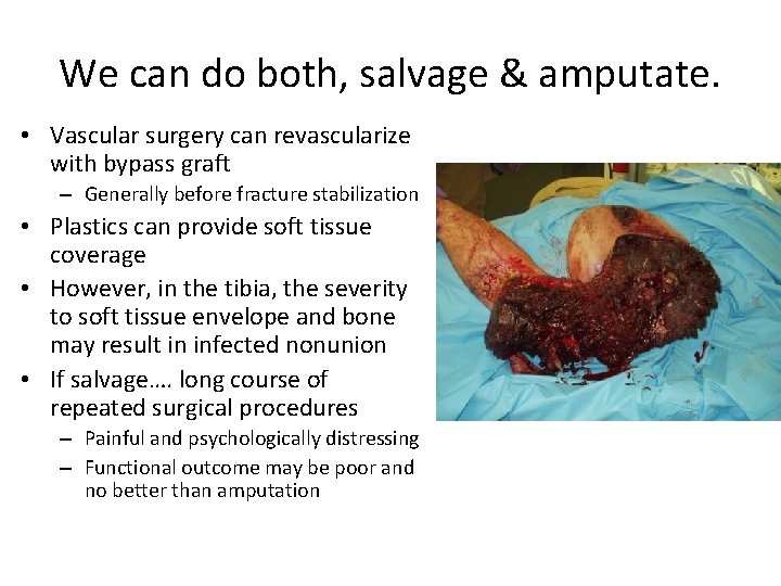 We can do both, salvage & amputate. • Vascular surgery can revascularize with bypass