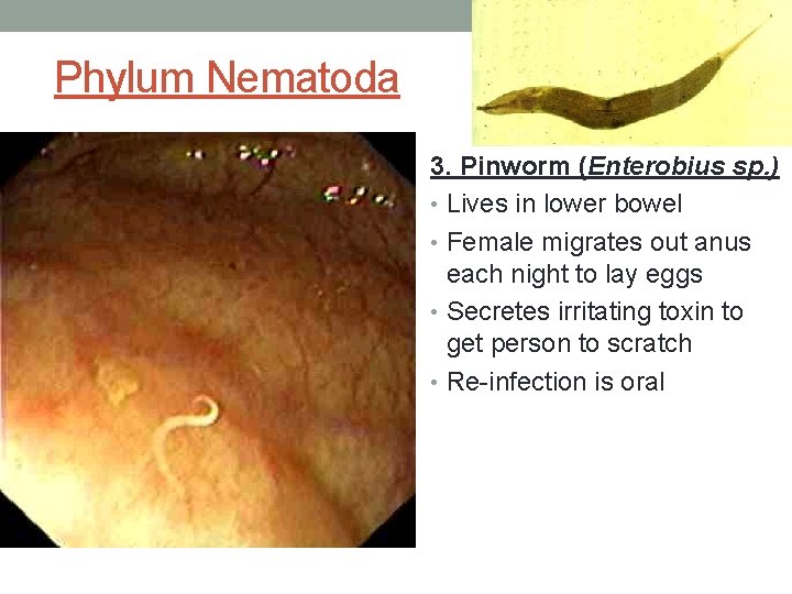 Phylum Nematoda 3. Pinworm (Enterobius sp. ) • Lives in lower bowel • Female