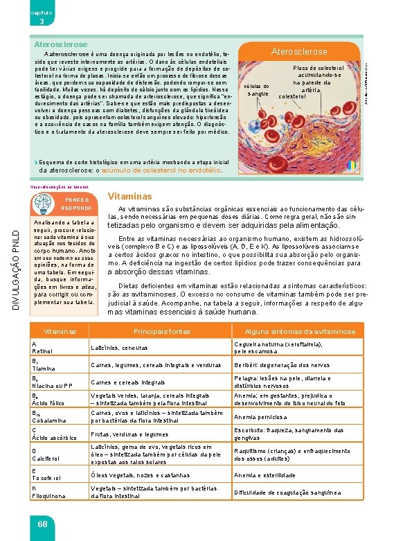 capítulo 3 Aterosclerose Placa de colesterol células do sangue acumulando-se na parede da artéria.