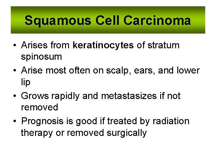 Squamous Cell Carcinoma • Arises from keratinocytes of stratum spinosum • Arise most often
