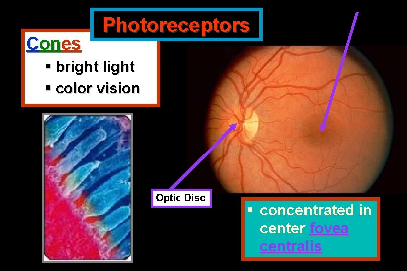 Cones Photoreceptors § bright light § color vision Optic Disc § concentrated in center