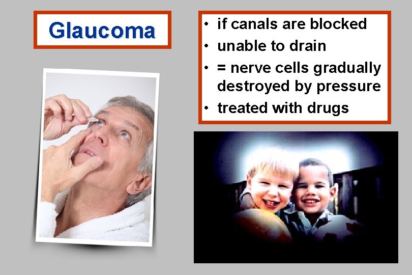 Glaucoma • if canals are blocked • unable to drain • = nerve cells