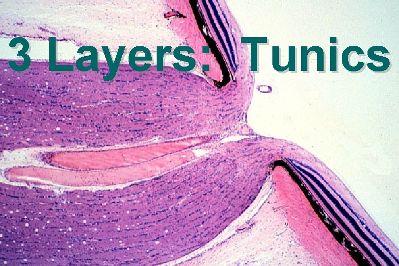 3 Layers: Tunics 
