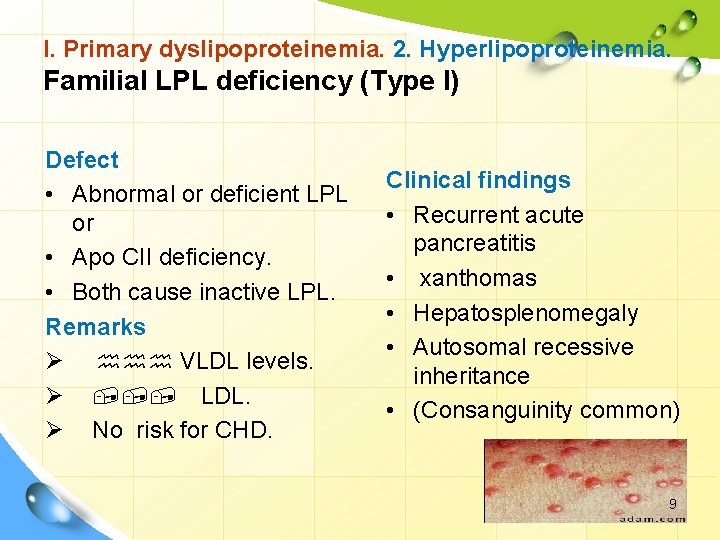 I. Primary dyslipoproteinemia. 2. Hyperlipoproteinemia. Familial LPL deficiency (Type I) Defect • Abnormal or