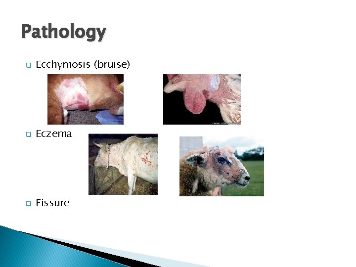 Pathology q Ecchymosis (bruise) q Eczema q Fissure 