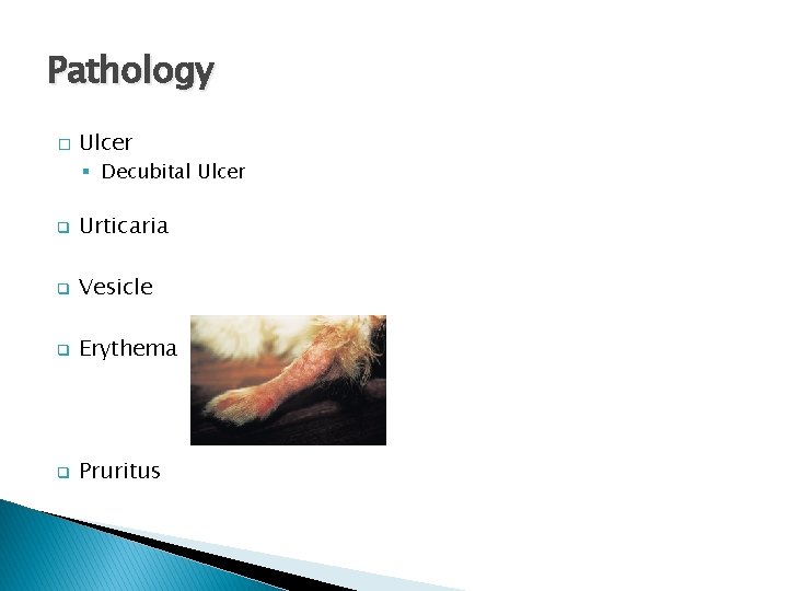 Pathology � Ulcer § Decubital Ulcer q Urticaria q Vesicle q Erythema q Pruritus
