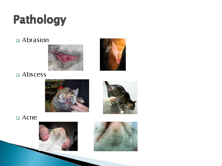Pathology q Abrasion q Abscess q Acne 