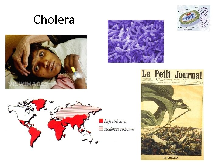 Cholera 