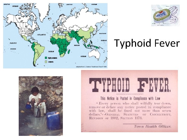 Typhoid Fever 