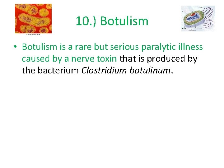 10. ) Botulism • Botulism is a rare but serious paralytic illness caused by