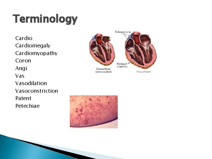 Terminology Cardiomegaly Cardiomyopathy Coron Angi Vasodilation Vasoconstriction Patent Petechiae 