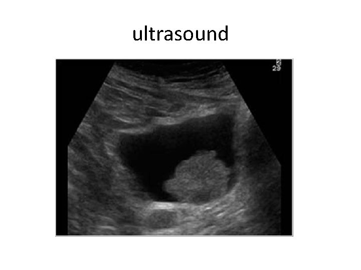 ultrasound 
