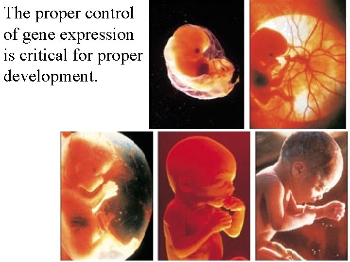 The proper control of gene expression is critical for proper development. 