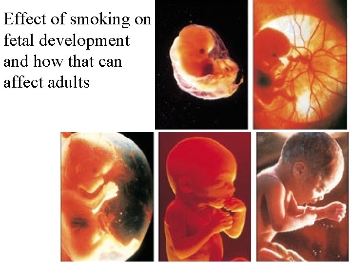 Effect of smoking on fetal development and how that can affect adults 