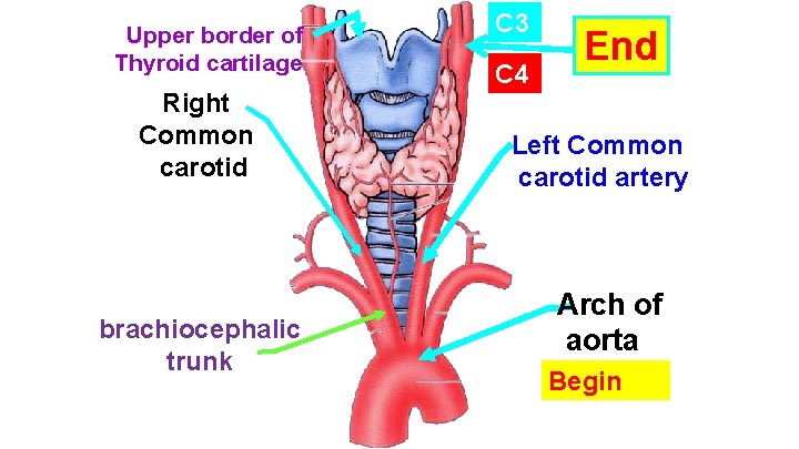 Upper border of Thyroid cartilage Right Common carotid brachiocephalic trunk C 3 C 4