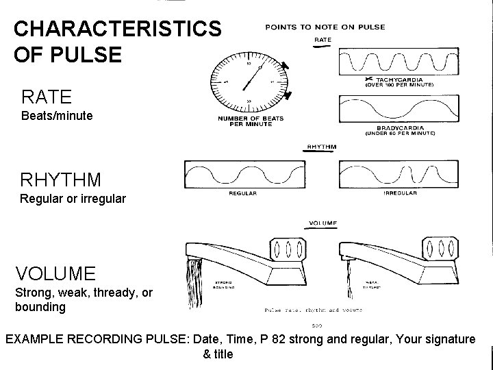 CHARACTERISTICS OF PULSE RATE Beats/minute RHYTHM Regular or irregular VOLUME Strong, weak, thready, or
