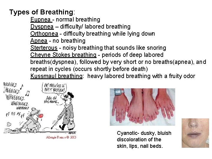 Types of Breathing: Eupnea - normal breathing Dyspnea – difficulty/ labored breathing Orthopnea -
