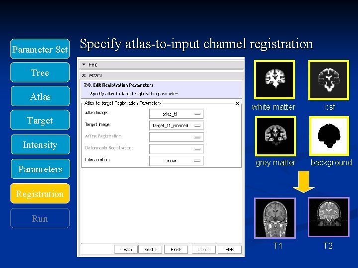 Parameter Set Specify atlas-to-input channel registration Tree Atlas white matter csf grey matter background
