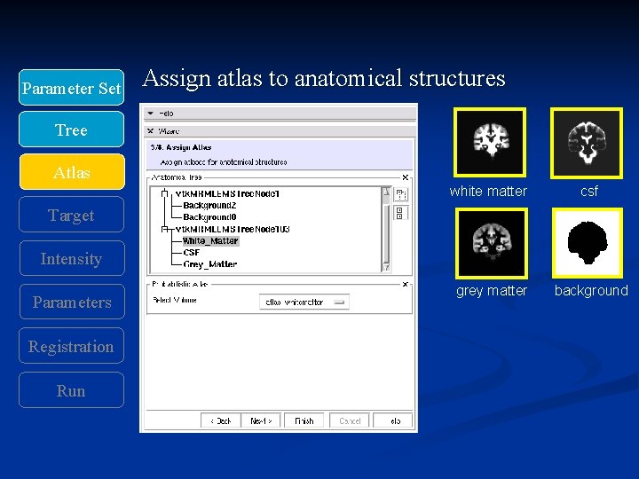 Parameter Set Assign atlas to anatomical structures Tree Atlas white matter csf grey matter