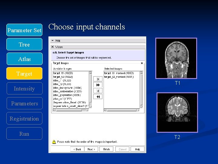 Parameter Set Choose input channels Tree Atlas Target Intensity T 1 Parameters Registration Run