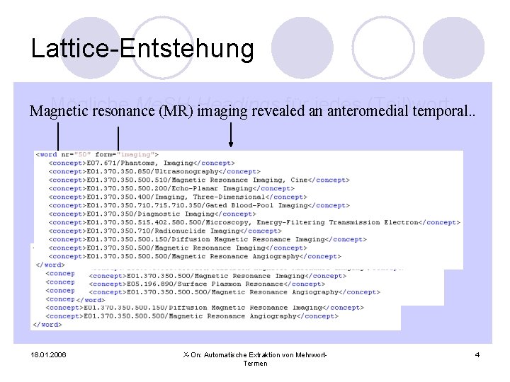 Lattice-Entstehung l Mögliche Me. SH-Headings füranjedes (Teil)wort Magnetic resonance (MR) imaging revealed anteromedial temporal.